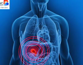 Bật Mí Nguyên Nhân Gây Sỏi Mật Bạn Cần Biết Để Phòng Ngừa Hiệu Quả